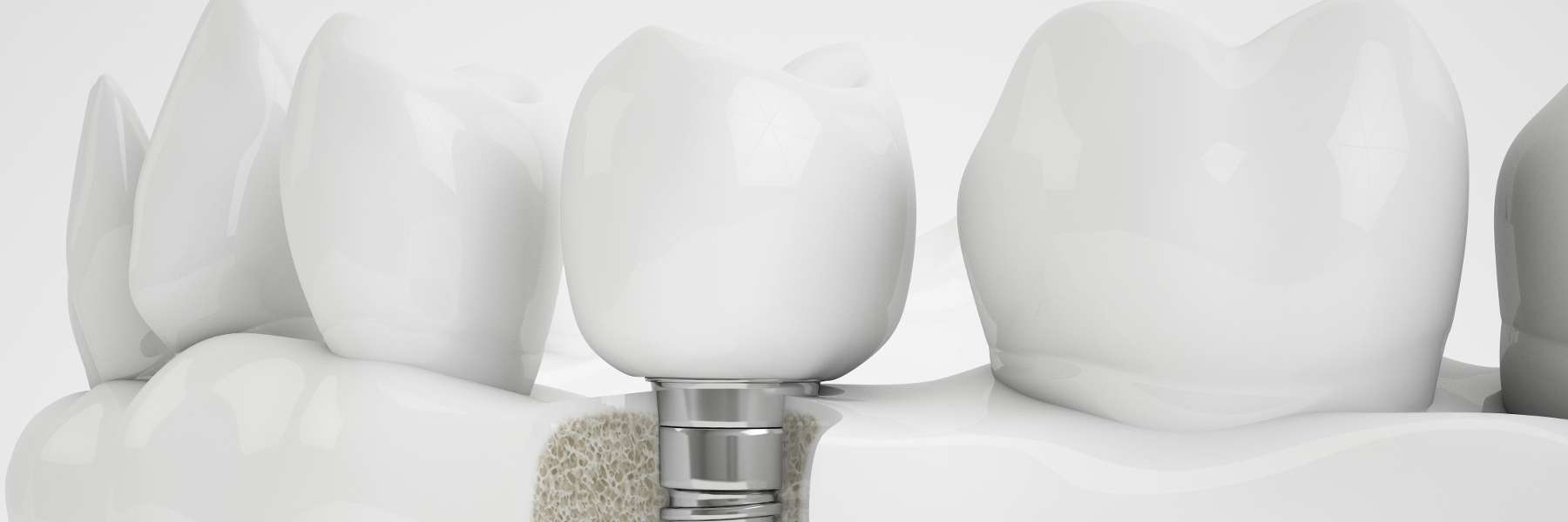 bradenton fl dentist